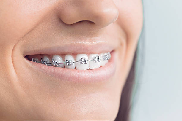 Laser Dentistry in Summerfield, MD